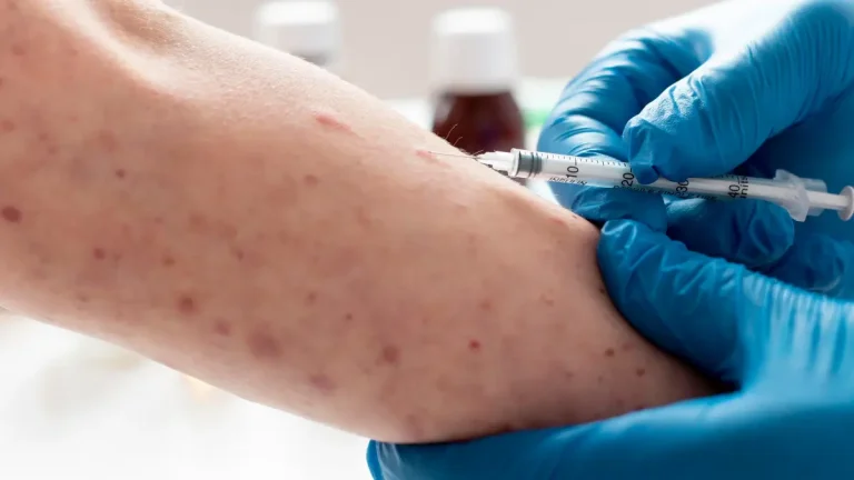 Mpox Cases Rise in South Africa: Gauteng Records Three as Health Department Urges Vigilance Mpox Cases Rise in South Africa: Gauteng Records Three as Health Department Urges Vigilance